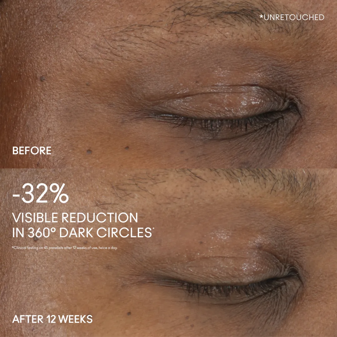 Hyper Real Serumizer™ Eye 360° Bright Eye Treatment - Image 2